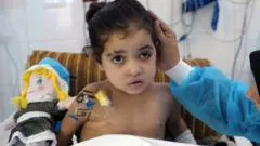 Raseel al-Balawi undergoes multiple surgeries after Gaza strike