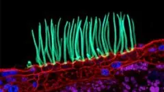 Nikon Small World contest controversy: AI in microscopy